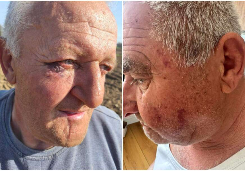 Бањалука: Полицијска бруталност над пензионерима?!