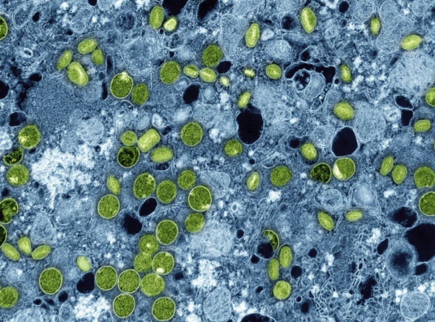 Epidemija malih boginja u Bangladešu odnosi živote