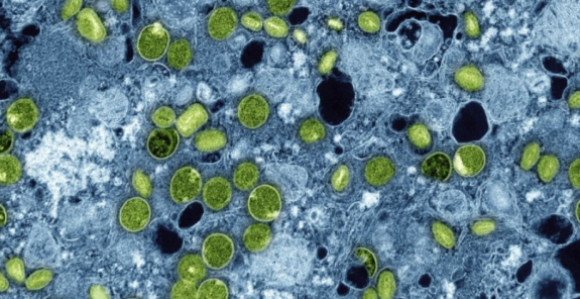 Epidemija malih boginja u Bangladešu odnosi živote