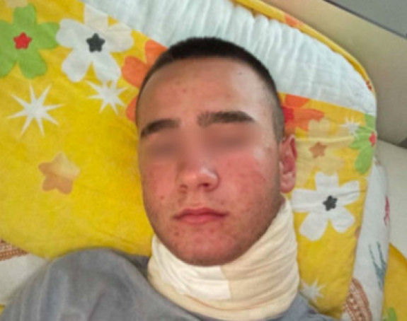 Полицији наложено да испита све у вези премлаћивања дјечака