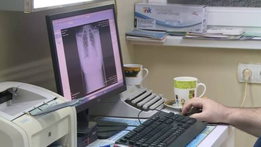 Službenike šalju privatnicima, a javni sistem propada