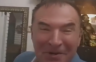 Pjevač otkrio šta se dogodilo sa licem: Nisam namjerno!