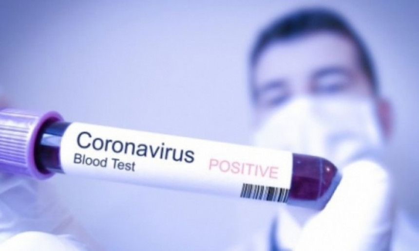 Три нова случаја вируса корона у Широком Бријегу