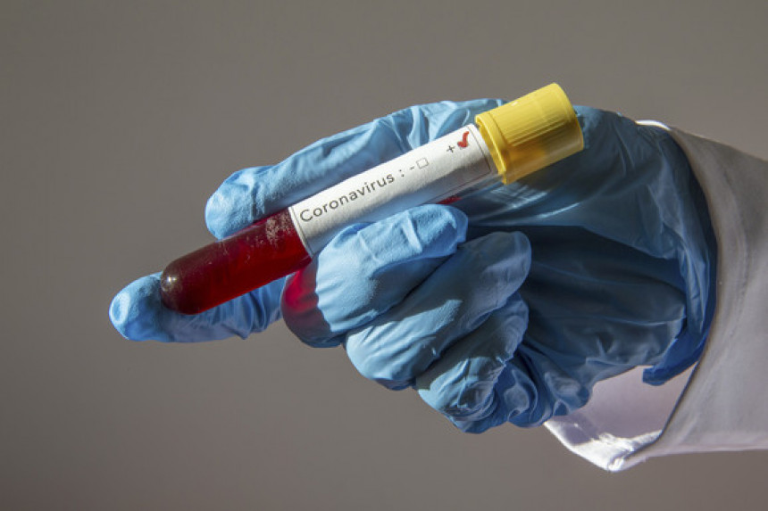 Два епидемиолога обољела су од вируса корона