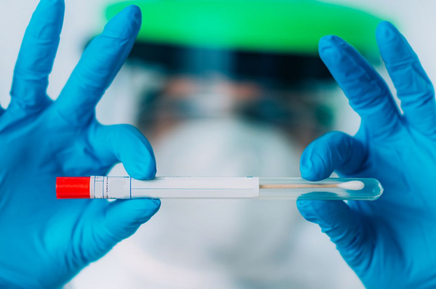 U BiH još nema govora o jeftinijim PCR testovima