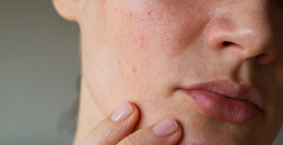 Ова промјена би могла бити први знак рака плућа