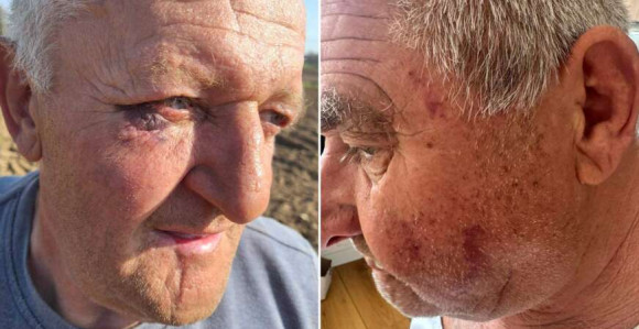 Бањалука: Полицијска бруталност над пензионерима?!